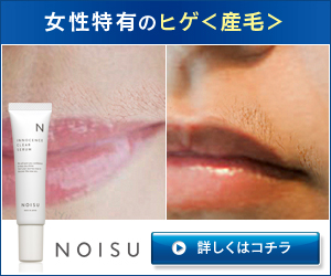 NOISU（ノイス）