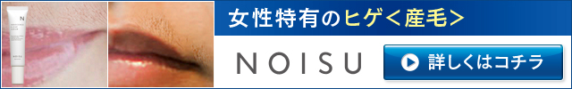 NOISU（ノイス）