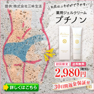ニキビ